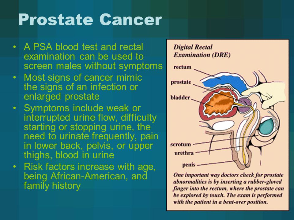 Can prostate be checked with blood test